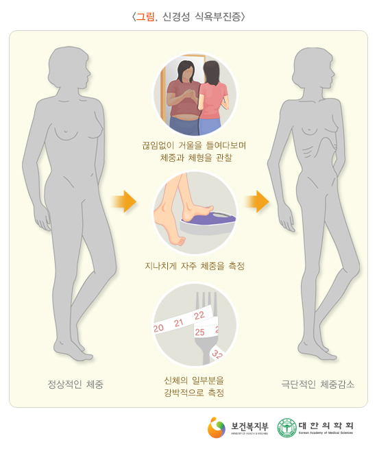 �Ű漺 �Ŀ������.jpg