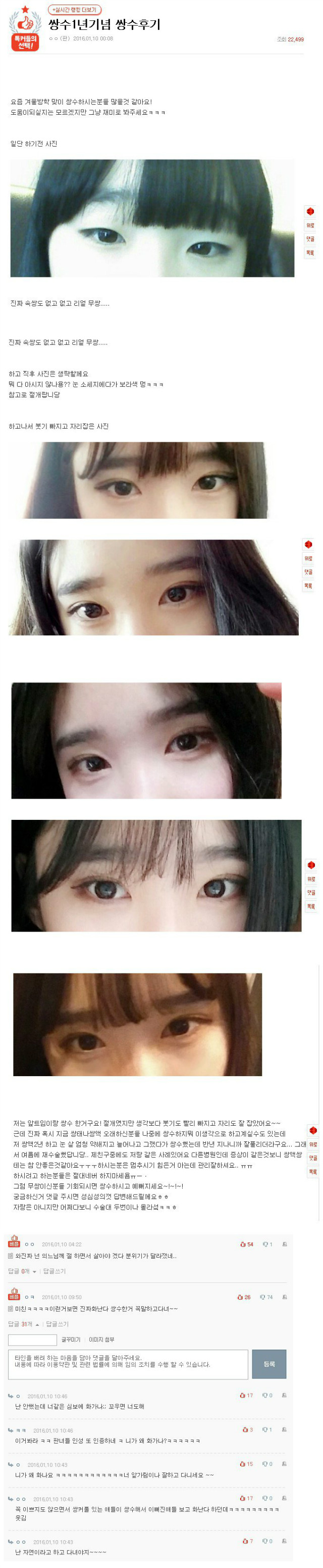 쌍수후기.jpg